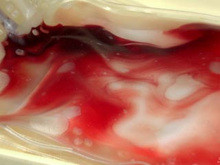 Captação de sangue Hemominas