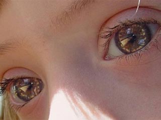 Foto: Divulgação Síndrome de Down