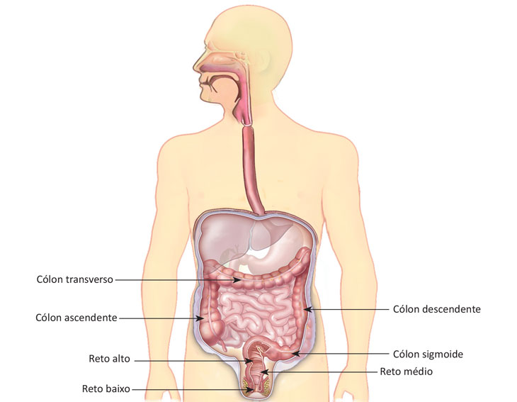 Hérnia inguinal nos praticantes de musculação - Hernia Clinic