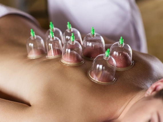 Foto: https://produto.mercadolivre.com.br/MLB-1135081835-kit-6-ventosas-ventosaterapia-massagem-acupuntura-terapia-_JM