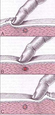 Foto: Divulgação/https://br.pinterest.com/do4787/pontos-de-gatilho/