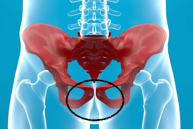 Foto: https://www.tuasaude.com/sintomas-de-pubalgia/