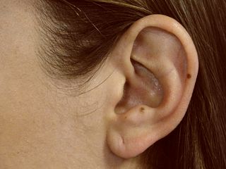 Foto de orelha