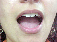 Foto de pessoa com a boca aberta