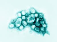 Imagem do vírus H1N1