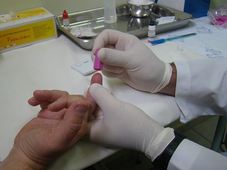 Teste Rápido de Aids/HIV