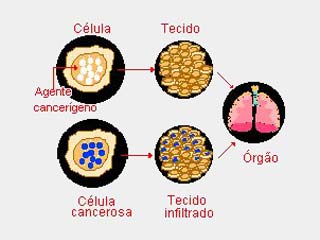 Célula Cancerosa