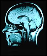 Foto site:
http://news.bbc.co.uk/hi/spanish/science/newsid_1372000/1372127.stm